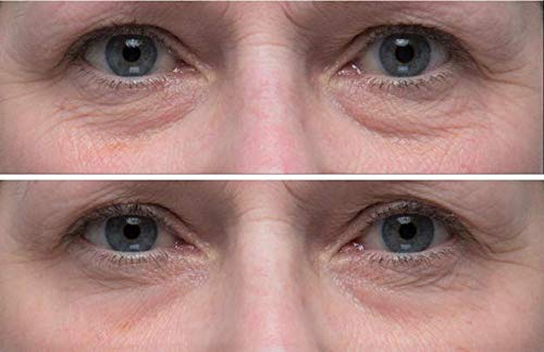 Хидратиращ емулсия за очи Dr. Denese SkinScience HydroShield с растителни стволови клетки, PCA-натрий, екстракт от диня, керамидами