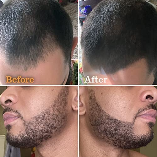 ФОЛЛИКСИЛ 5% отговарят Лосион За Растеж на косата с Миноксидилом и Дръжка-Пълнител за оформяне на брада, Среден Черен Цвят