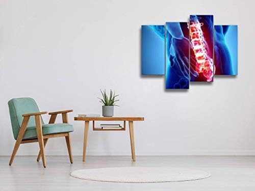Платно Стенни Художествена Живопис 3D Картини с образа на Болка в Крестцовом Отдел на гръбначния Стълб Съвременно Произведение,