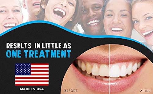 Комплект за избелване на зъбите Bright White Smiles, 35% гел с бензоил пероксид за професионален резултат в домашни условия, система за пълнене