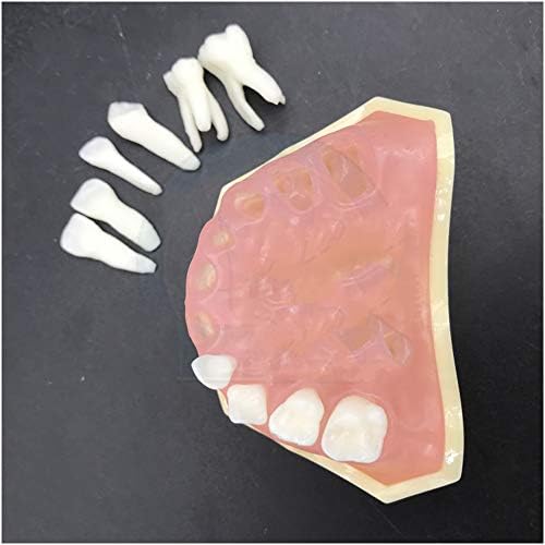 Модел на млечните зъби LEMITA Модел на зъбите за обучение - 20 бр стандартния модел на Възстановяване на зъби - Подвижни Меки венци - демонстрация за обучение на стомато?